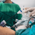 Laparoscopic Surgery Recovery Timeline: Week-by-Week Guide