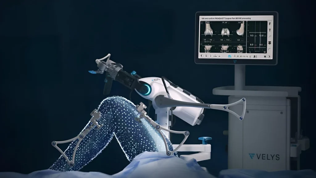 Surgeons performing robotic knee replacement surgery in a modern operating room using advanced robotic-assisted equipment and minimally invasive techniques