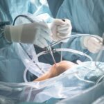 Orthopedic Surgery Overview: Instruments and Workflow