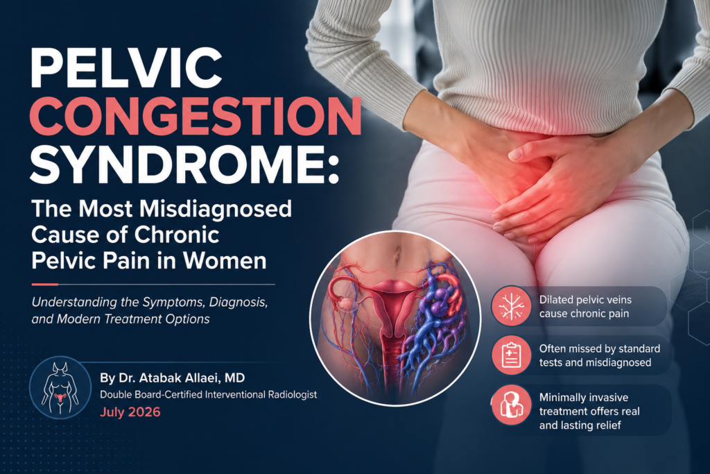 Pelvic Congestion Syndrome Causes, Symptoms & Treatment