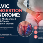 Pelvic Congestion Syndrome: The Most Misdiagnosed Cause of Chronic Pelvic Pain in Women